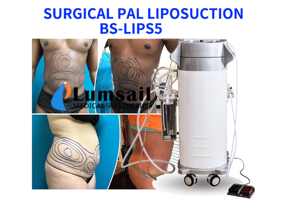 PAL Ultrasonic Surgical Liposuction Machine Slimming Beauty Equipment With Cannula Set